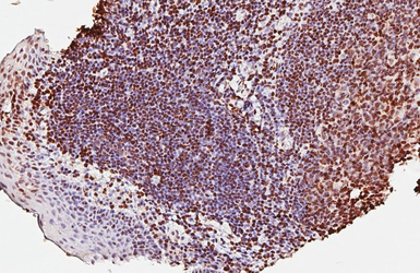 Anti-PARP antibody [GT6212] used in IHC (Paraffin sections) (IHC-P). GTX628836