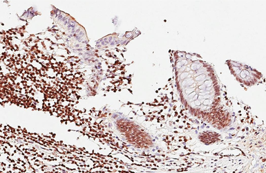 Anti-PARP antibody [GT6212] used in IHC (Paraffin sections) (IHC-P). GTX628836