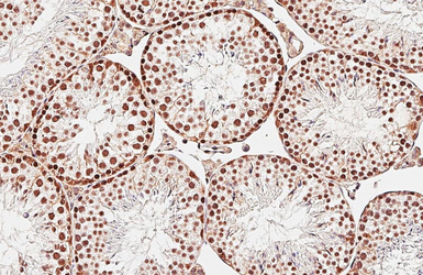 Anti-PARP antibody [GT6212] used in IHC (Paraffin sections) (IHC-P). GTX628836