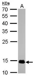 Anti-COX4 antibody [GT6310] used in Western Blot (WB). GTX628886