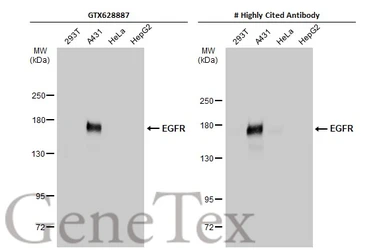 Anti-EGFR antibody [GT133] used in Western Blot (WB). GTX628887