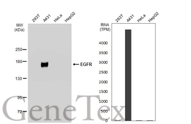 Anti-EGFR antibody [GT461] used in Western Blot (WB). GTX628888