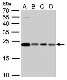 Anti-Glyoxalase I antibody [GT266] used in Western Blot (WB). GTX628889