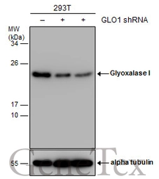 Anti-Glyoxalase I antibody [GT552] used in Western Blot (WB). GTX628890