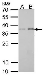 Anti-PEX19 antibody [GT533] used in Western Blot (WB). GTX628892