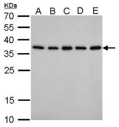 Anti-PEX19 antibody [GT533] used in Western Blot (WB). GTX628892