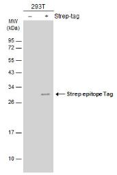Anti-Strep epitope Tag antibody [GT661] used in Western Blot (WB). GTX628900