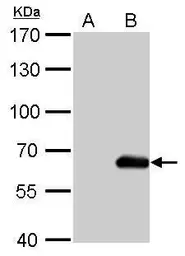 Anti-HA tag antibody [GT4810] used in Western Blot (WB). GTX628902