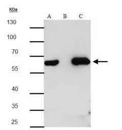 Anti-HA tag antibody [GT4810] used in Immunoprecipitation (IP). GTX628902