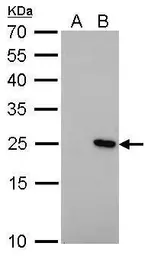 Anti-Bcl-2 antibody [GT576] used in Western Blot (WB). GTX628904