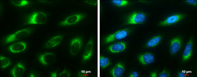 Anti-Ribosome binding protein 1 antibody [GT1611] used in Immunocytochemistry/ Immunofluorescence (ICC/IF). GTX628997