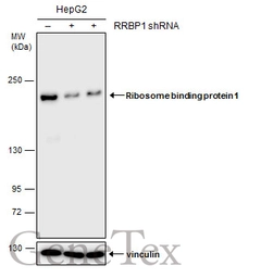 Anti-Ribosome binding protein 1 antibody [GT5610] used in Western Blot (WB). GTX628998
