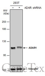 Anti-ADAR1 antibody [GT1066] used in Western Blot (WB). GTX629000