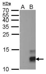 Anti-Pancreatic Polypeptide antibody [GT327] used in Western Blot (WB). GTX629070