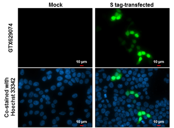 Anti-S Tag antibody [GT727] used in Immunocytochemistry/ Immunofluorescence (ICC/IF). GTX629074