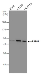 Anti-PAF49 antibody [GT635] used in Western Blot (WB). GTX629076