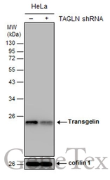 Anti-Transgelin antibody [GT4511] used in Western Blot (WB). GTX629078