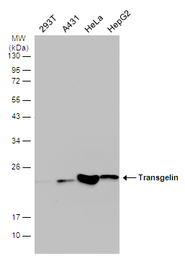 Anti-Transgelin antibody [GT4511] used in Western Blot (WB). GTX629078
