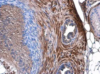 Anti-Transgelin antibody [GT4511] used in IHC (Paraffin sections) (IHC-P). GTX629078