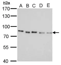 Anti-PAF49 antibody [GT1964] used in Western Blot (WB). GTX629115