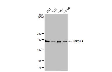 Anti-NFKBIL2 antibody [GT648] used in Western Blot (WB). GTX629396