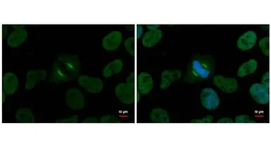 Anti-NuMA antibody [GT3611] used in Immunocytochemistry/ Immunofluorescence (ICC/IF). GTX629397