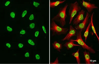 Anti-NuMA antibody [GT3611] used in Immunocytochemistry/ Immunofluorescence (ICC/IF). GTX629397