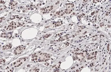 Anti-NuMA antibody [GT3611] used in IHC (Paraffin sections) (IHC-P). GTX629397