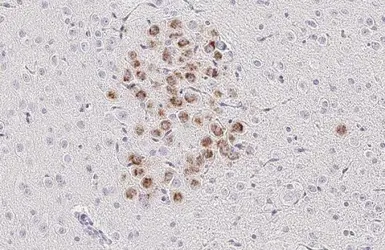 Anti-NuMA antibody [GT3611] used in IHC (Paraffin sections) (IHC-P). GTX629397