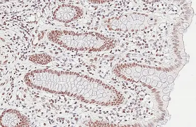 Anti-NuMA antibody [GT3611] used in IHC (Paraffin sections) (IHC-P). GTX629397