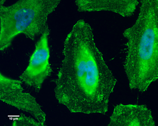 Anti-GEF-H1 antibody [GT336] used in Immunocytochemistry/ Immunofluorescence (ICC/IF). GTX629398