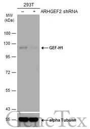 Anti-GEF-H1 antibody [GT336] used in Western Blot (WB). GTX629398