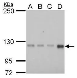 Anti-GEF-H1 antibody [GT336] used in Western Blot (WB). GTX629398