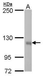 Anti-GEF-H1 antibody [GT336] used in Western Blot (WB). GTX629398