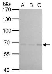Anti-cIAP1 antibody [GT422] used in Western Blot (WB). GTX629402