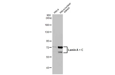 Anti-Lamin A + C antibody [GT9712] used in Western Blot (WB). GTX629404