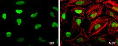 Anti-HMGB1 antibody [GT427] used in Immunocytochemistry/ Immunofluorescence (ICC/IF). GTX629445