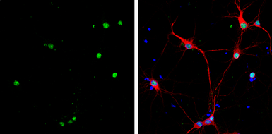 Anti-HMGB1 antibody [GT427] used in Immunocytochemistry/ Immunofluorescence (ICC/IF). GTX629445