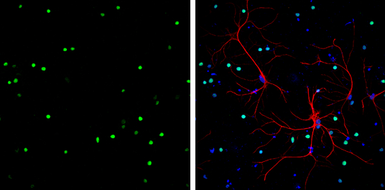 Anti-HMGB1 antibody [GT427] used in Immunocytochemistry/ Immunofluorescence (ICC/IF). GTX629445