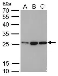 Anti-HMGB1 antibody [GT427] used in Western Blot (WB). GTX629445