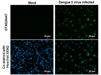 Anti-Dengue virus NS5 protein antibody [GT361] used in Immunocytochemistry/ Immunofluorescence (ICC/IF). GTX629447