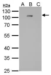 Anti-Dengue virus NS5 protein antibody [GT361] used in Western Blot (WB). GTX629447