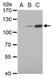 Anti-Dengue virus NS5 protein antibody [GT361] used in Western Blot (WB). GTX629447