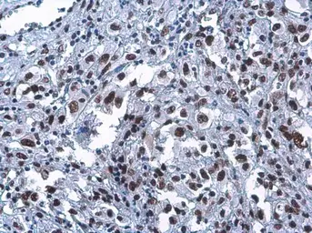 Anti-CFDP1 antibody [GT9612] used in IHC (Paraffin sections) (IHC-P). GTX629476