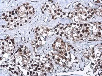 Anti-CFDP1 antibody [GT9612] used in IHC (Paraffin sections) (IHC-P). GTX629476