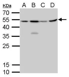 Anti-CFDP1 antibody [GT9612] used in Western Blot (WB). GTX629476