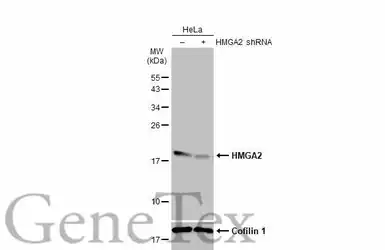 Anti-HMGA2 antibody [GT763] used in Western Blot (WB). GTX629478