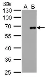 Anti-Factor X antibody [GT268] used in Western Blot (WB). GTX629480