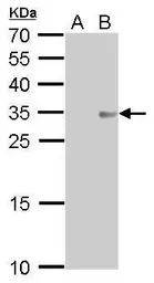 Anti-COL11A2 antibody [GT212] used in Western Blot (WB). GTX629481
