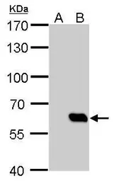 Anti-HA tag antibody [GT134] used in Western Blot (WB). GTX629540